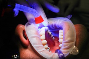 dentist-1864921_1920